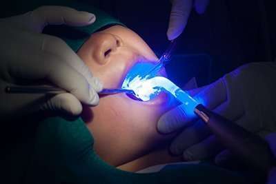 child getting dental sealants