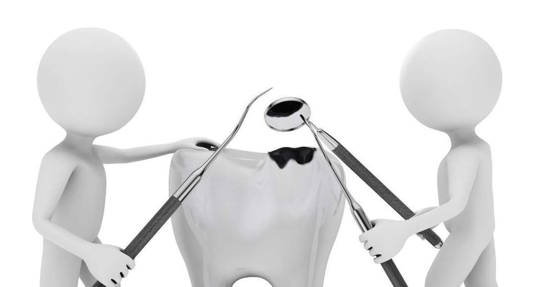 inspecting tooth decay