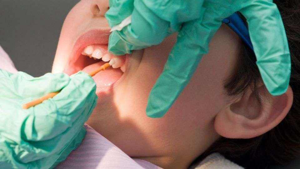dentist applying fluoride treatment to child's teeth